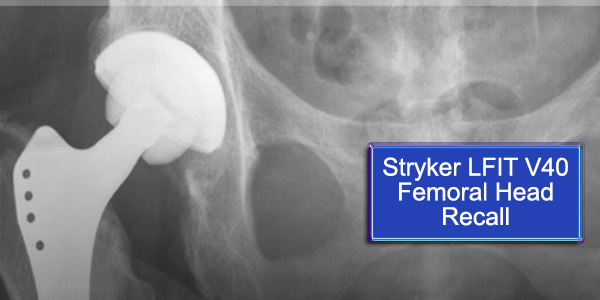 Stryker Hip Replacement Lawsuit Filed Over Increased