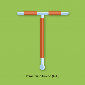 Paragard IUD Lawsuit